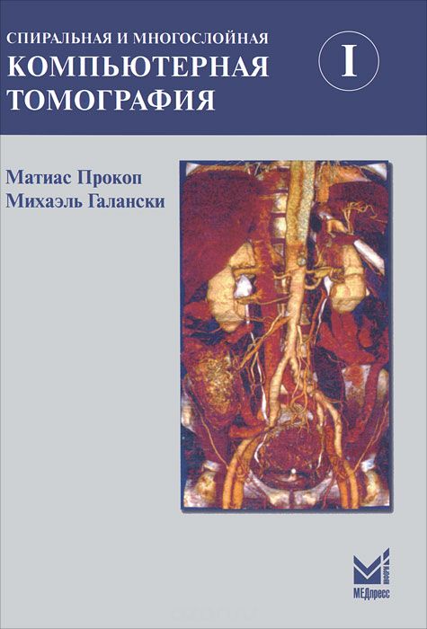 Спиральная и многослойная компьютерная томография. В 2 томах. Том 1, Матиас Прокоп, Михаэль Галански