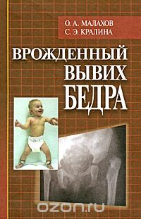 Скачать книгу "Врожденный вывих бедра, О. А. Малахов, С. Э. Кралина"