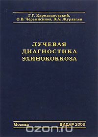 Скачать книгу "Лучевая диагностика эхинококкоза, Г. Г. Кармазановский, О. В. Черемисинов, В. А. Журавлев"